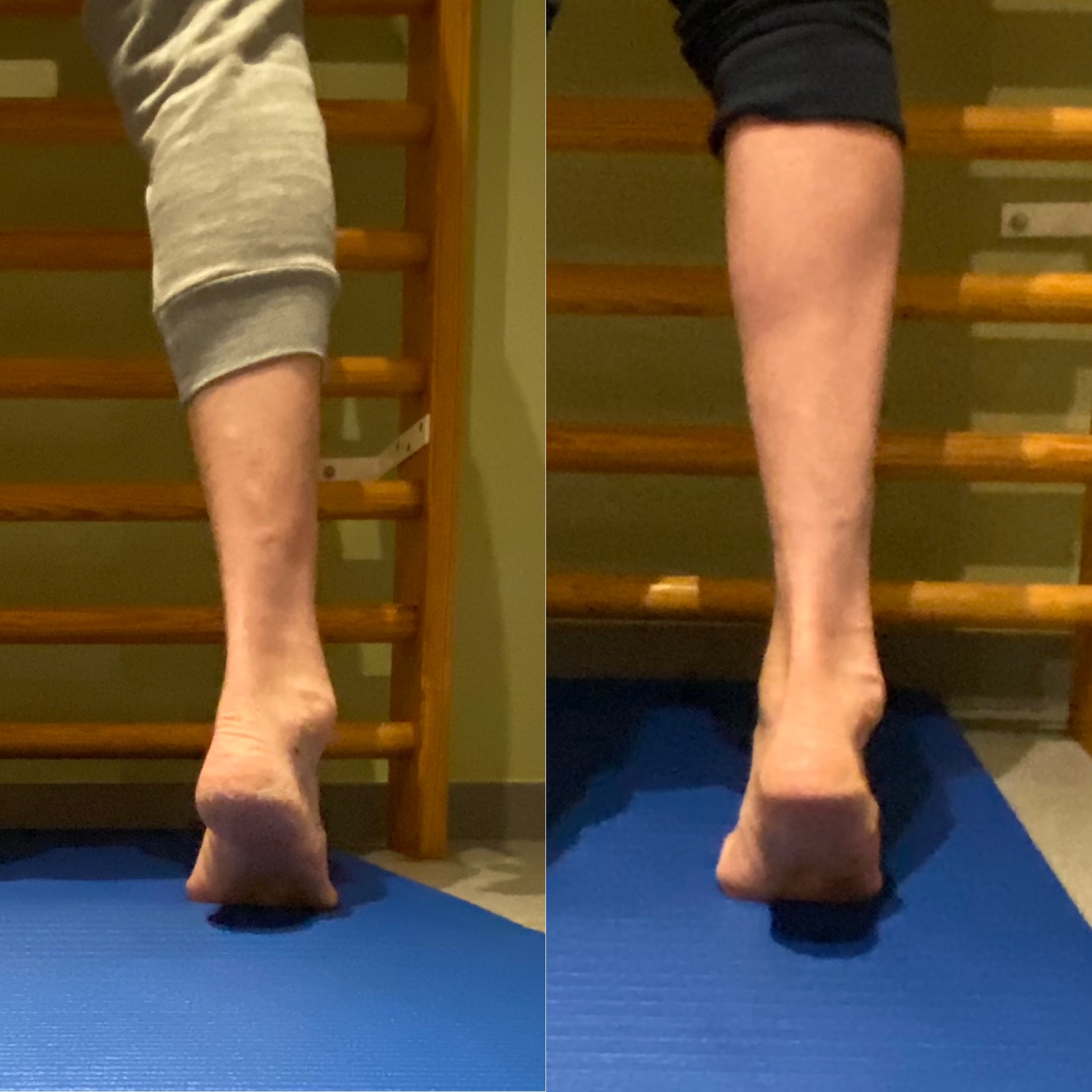 recode-ankles